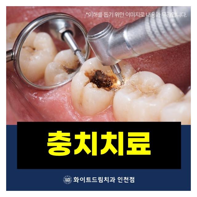 충치치료 일반진료도 편안하게 받으세요